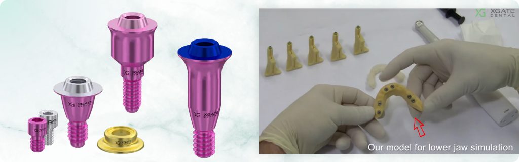 Intraoral sleeve cementation protocol, video guide