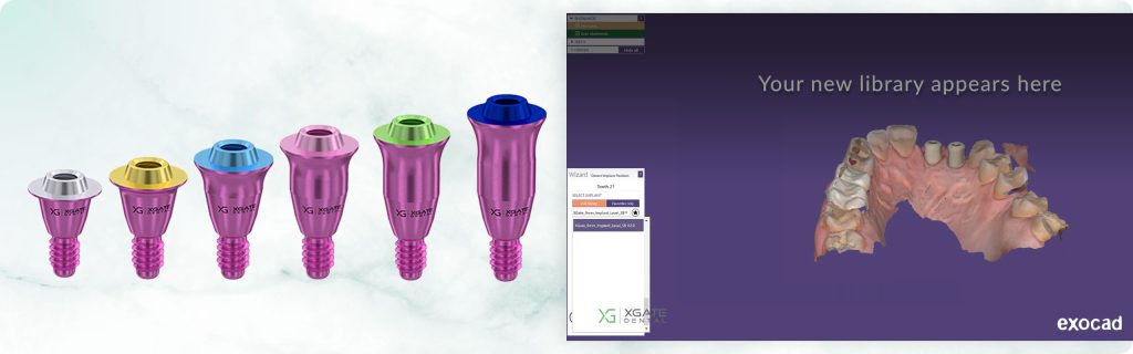 How to download and import XGATE Dental libraries, video guide