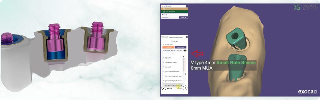 Choosing between regular and small screw channels for V-type multi units.
