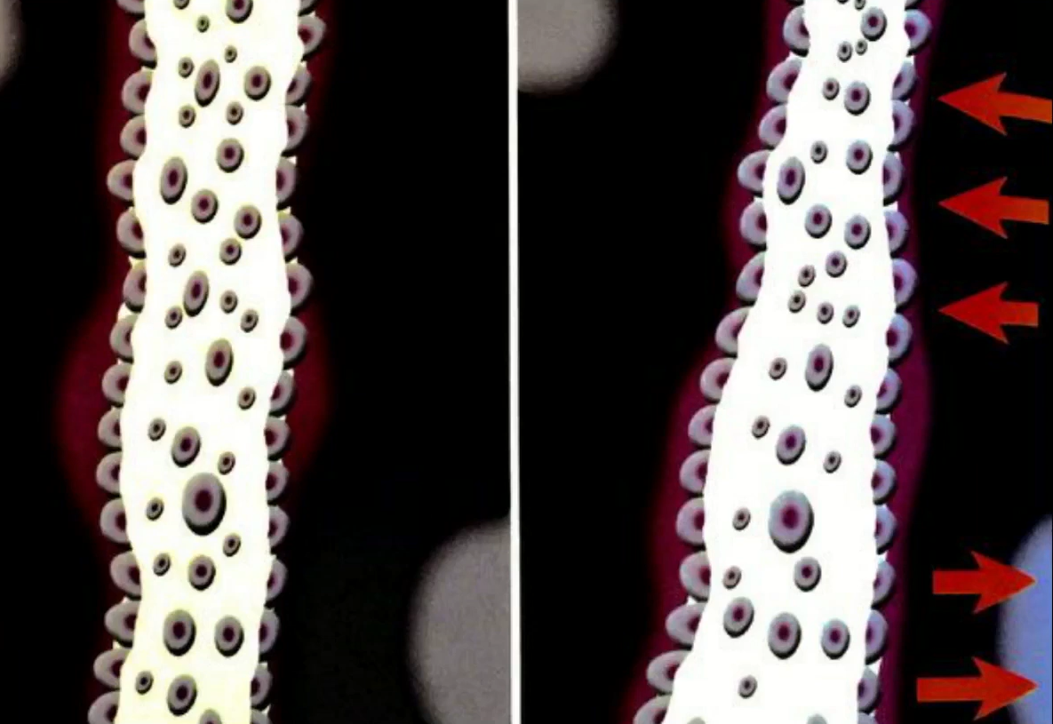 Too large a gap between the bone tissue and the implant surface