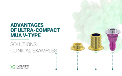 Advantages of Ultra-Compact MUA V-Type Solutions: Clinical Examples