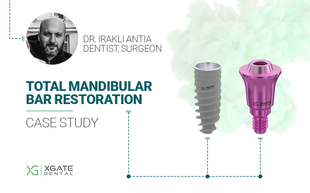 Total Mandibular Bar Restoration: Screw Retention Using MUA V-Type with Ultra Low Profile