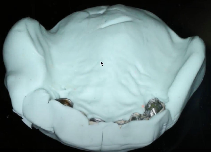 Full cast of the upper jaw with the palatal part, which will help in the production of restoration YouTube / Dr. Kamil Khabiev / Dental Guru Academy
