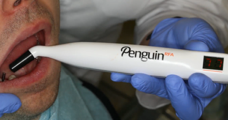 A device for measuring the primary stability of an implant, utilizing the same principle of resonance frequency analysis (RFA) YouTube / Dr. Kamil Khabiev / Dental Guru Academy