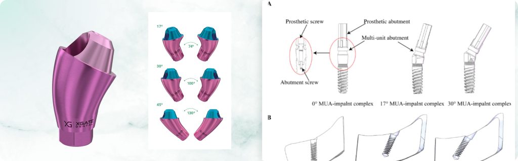 Screw Retention on Multi-Unit Abutments: What Happens to Implants, Screws, and Bone Tissue Under Vertical and Horizontal Loads