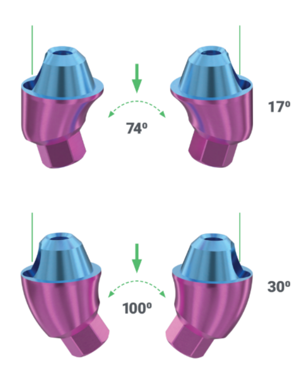 XGate 17° and 30° angled abutments are capable of compensating for implant angulations of up to 74° and 100°, respectively