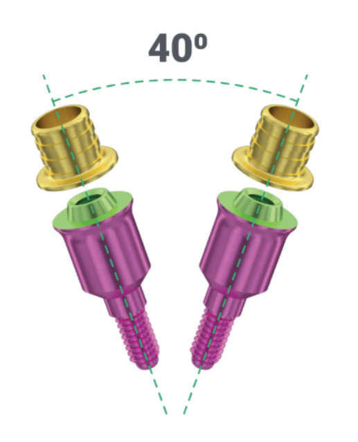 V-type abutments with standard sleeves: angulation compensation up to 40° possible
