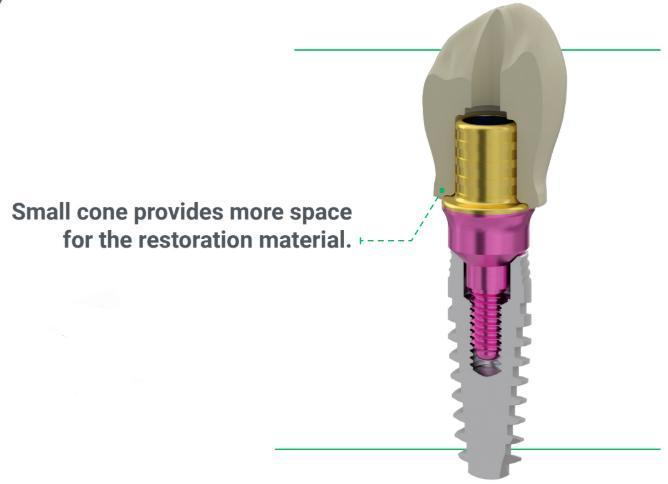 Diagram of a dental implant component, illustrating a XGate Dental V-type abutment and how its small cone design provides more space for the restoration material.