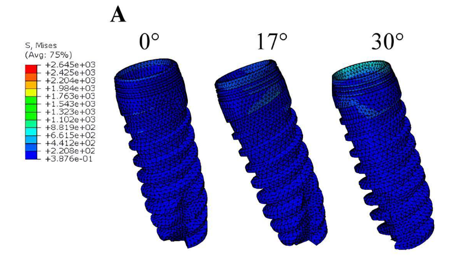 The stress distribution of the implant of the MUA-implant complex with different abutment angulation (0°, 17° and 30°). A, The stress distribution of implants under loading condition A, B. The stress distribution of implants under loading condition B.C, The stress distribution of implants under loading condition C. Research Square/ rs-4446322/v1/ Dong Lin/ Jun 2024