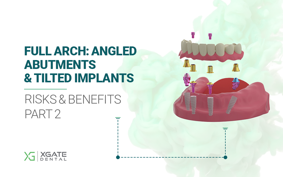 Angled Abutments and Tilted Implants