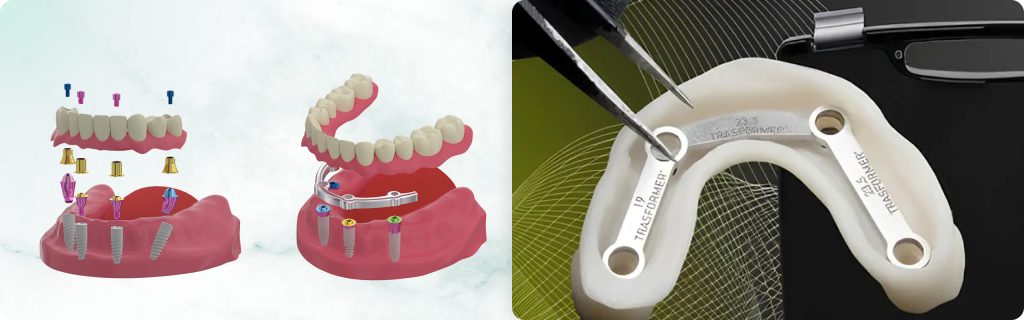 Angled Abutments and Tilted Implants – Risks and Benefits. Part 2