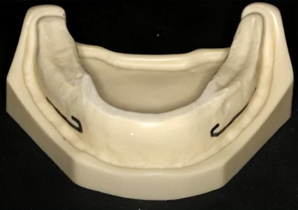 Bare jaw model for training implant placement