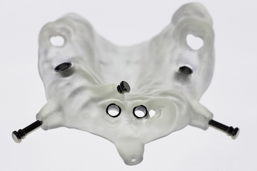 Surgical template for placement of 4 implants from Shutterstock