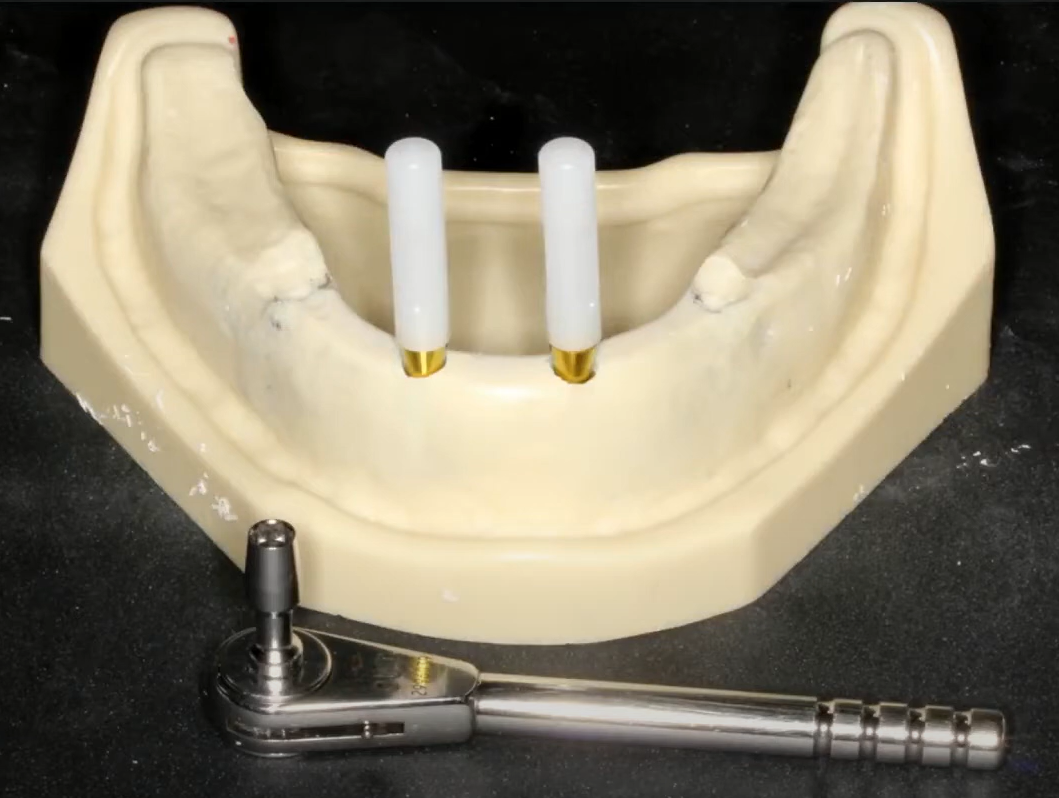 Installation of multi-unit abutments using special break-away carriers