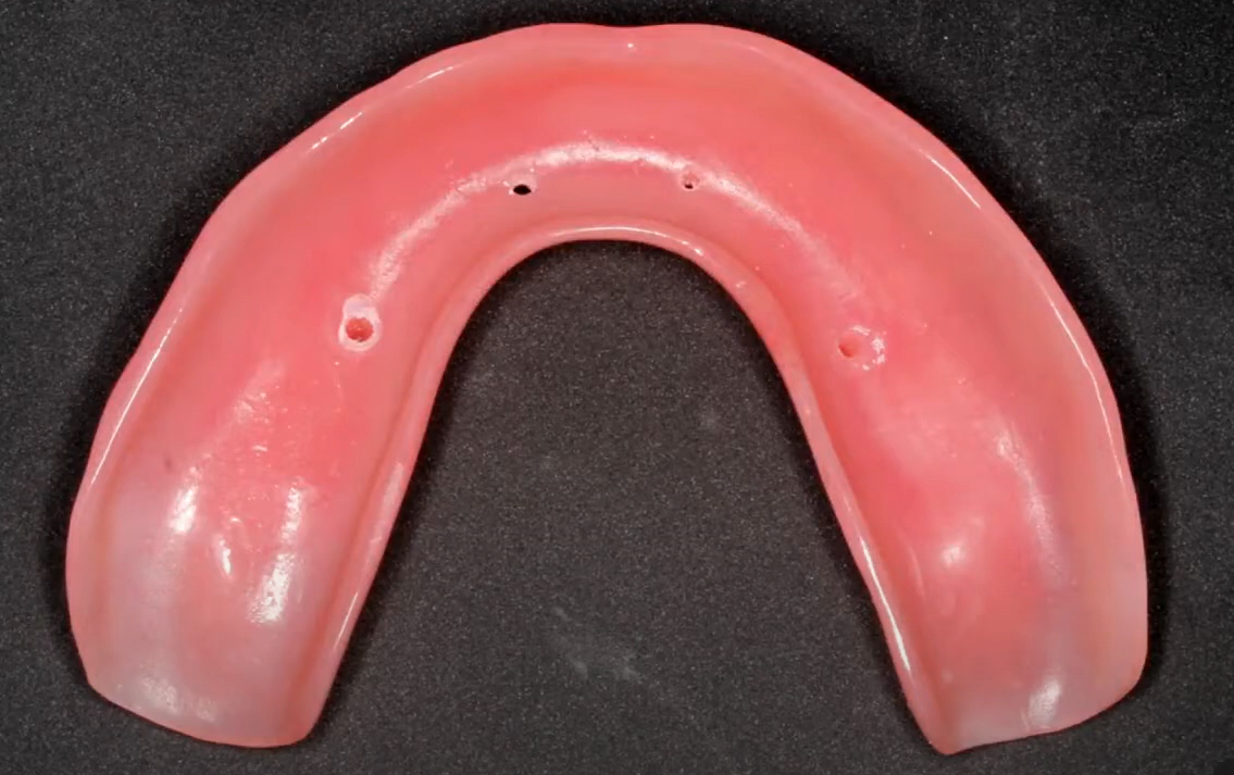 Marking for future screw access channels