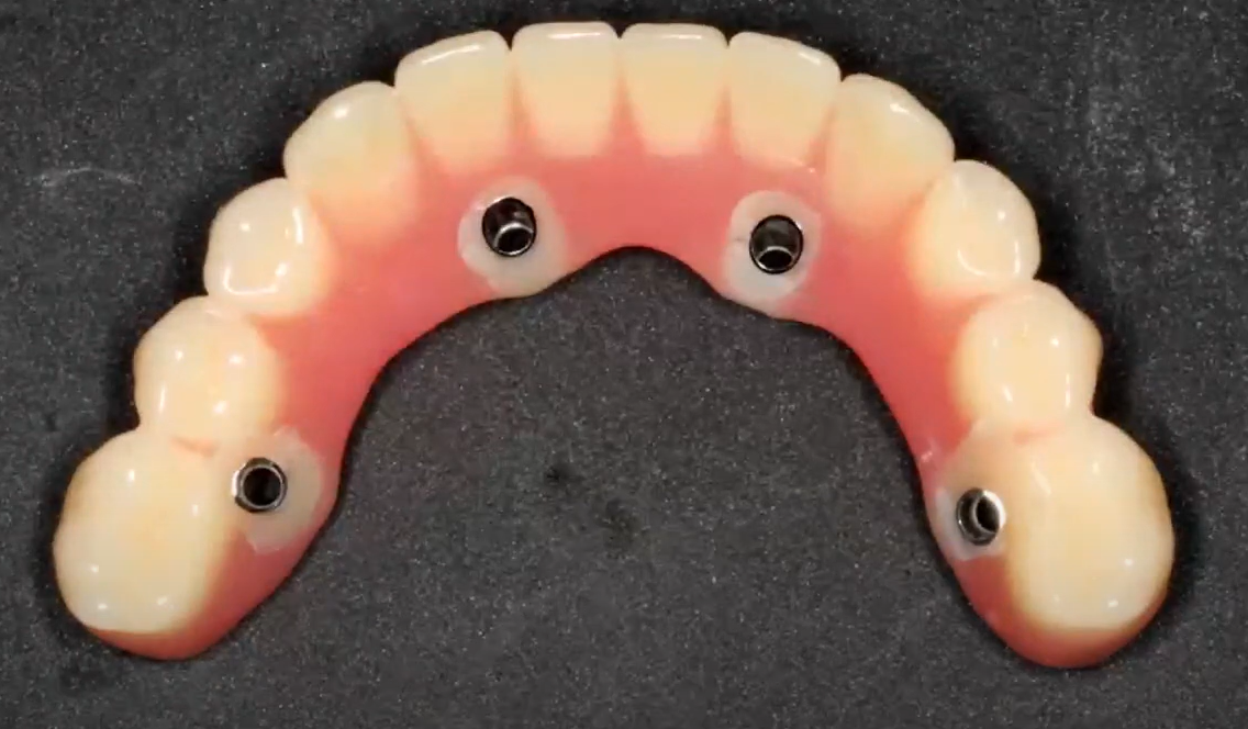 Polished denture intaglio view