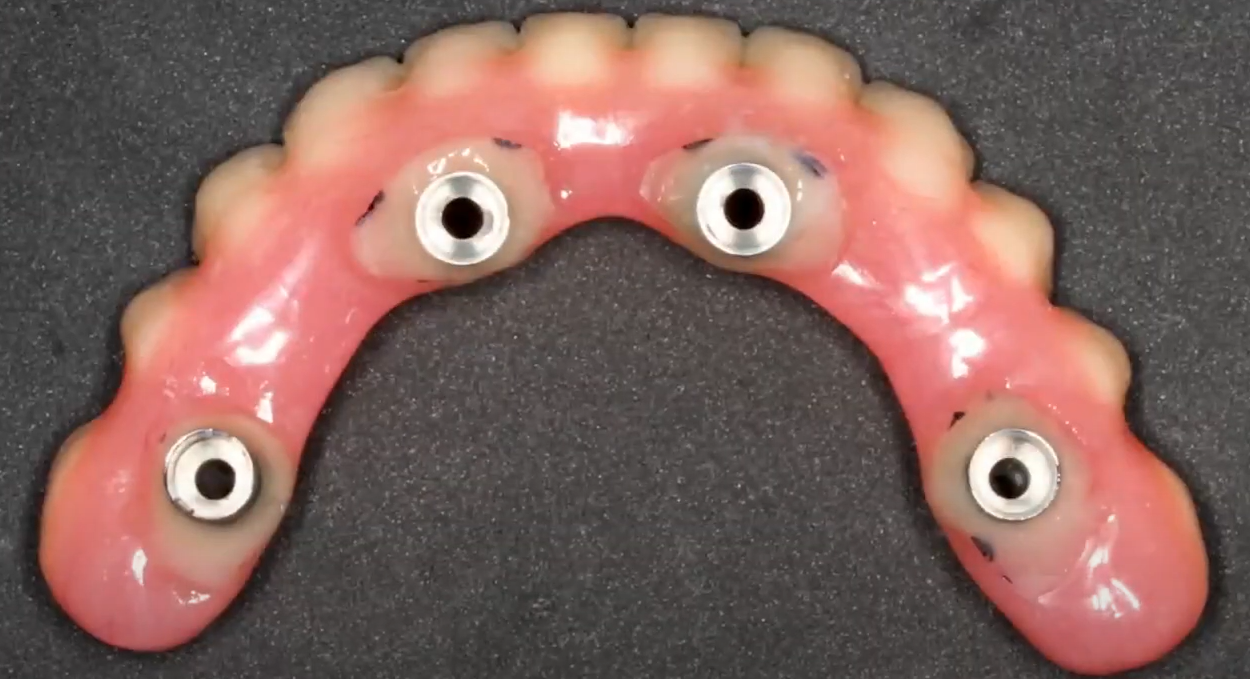 Polished denture ready for delivery
