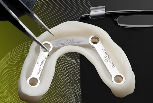 Reinforcing links for strengthening plastic dentures