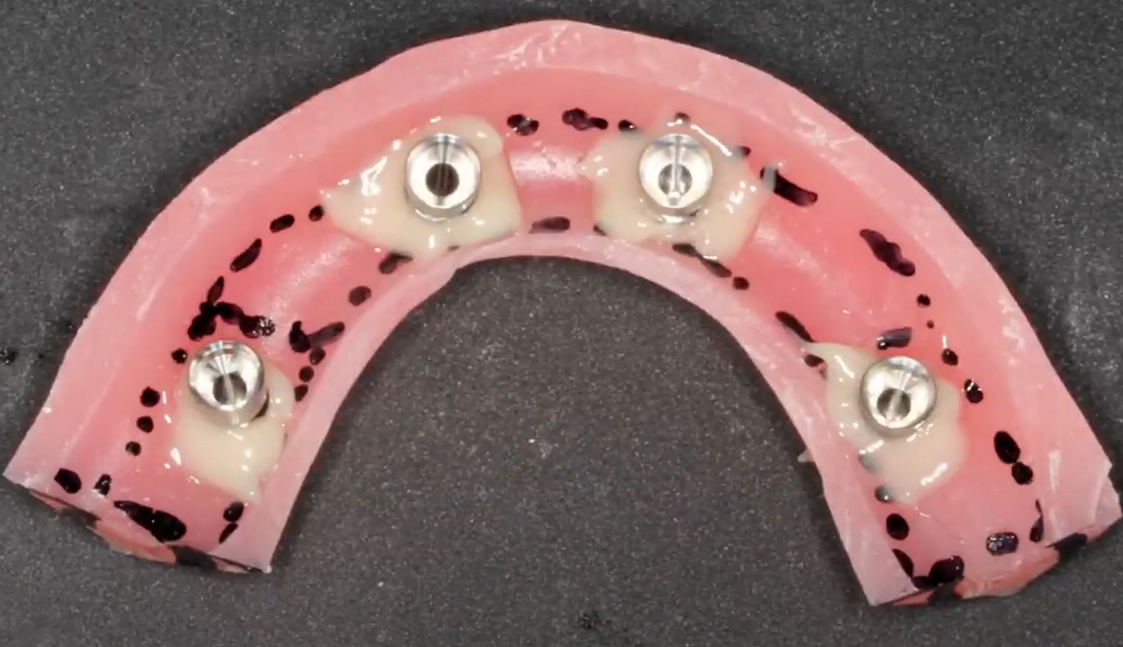Securing the cylinders in the body of the prosthesis