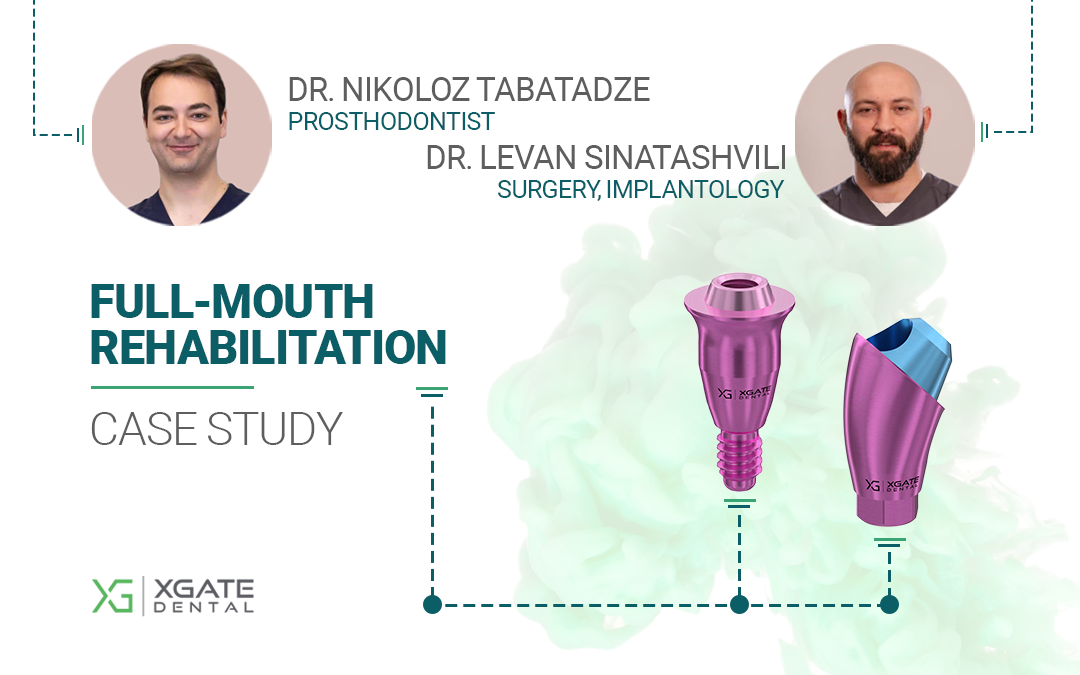 Full-Mouth Rehabilitation. Screw-retained MUA by XGATE Full-Mouth Rehabilitation. Screw-retained MUA by XGATE