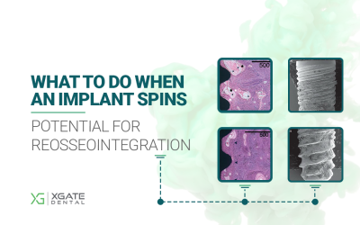 What to Do When an Implant Spins: What We Know About the Potential for Reosseointegration