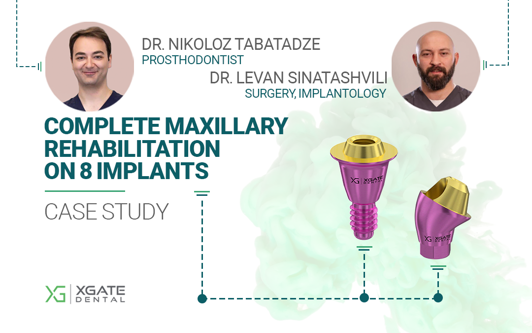 Maxillary rehabilitation 8-implants case