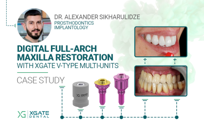 Full-Arch Restoration of the Maxilla Using a Digital Protocol and Ultra-Compact XGATE Dental V-Type Multi-Units