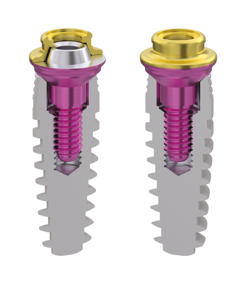 Ultra-low profile 0.5mm sleeve for MUA support without screw shaft formation in challenging clinical situations