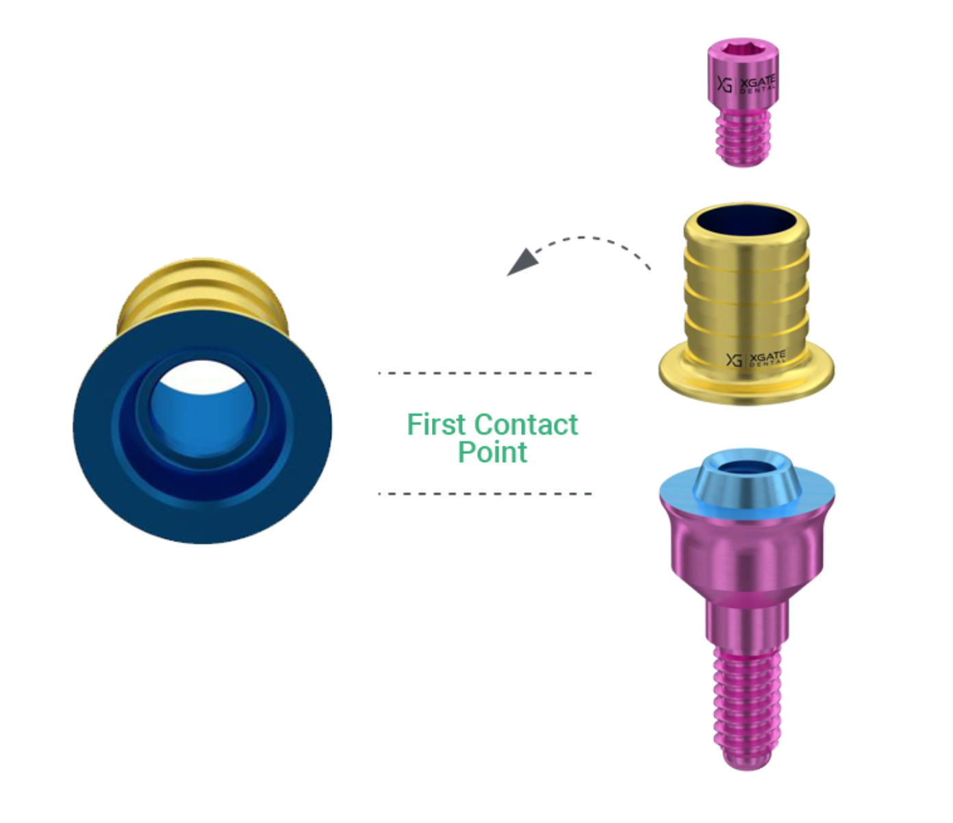 XGATE Dental MUA V-Type multi-unit abutments components for full-arch implant restorations