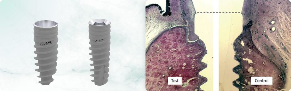 Why Double Platform Switching Doesn’t Always Work and How the Implant-Abutment Connection Affects Soft Tissue Integration and Marginal Bone Loss