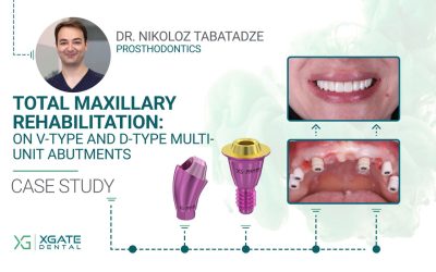 Total Maxillary Rehabilitation: Fixation of a Zirconia Prosthesis on V-Type and D-Type Multi-Unit Abutments