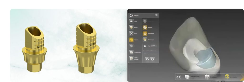 Implant-Supported Prosthetics in Aesthetically Significant Areas: Features of Gingival Attachment Formation