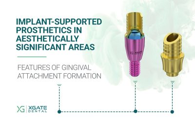 Implant-Supported Prosthetics in Aesthetically Significant Areas: Features of Gingival Attachment Formation