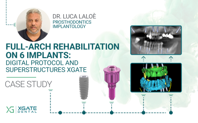 Full-Arch Rehabilitation of the Maxilla and the Mandible Using a Digital Protocol and Superstructures by XGATE Dental