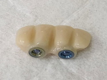 Photo of a time bridge with sleeves glued