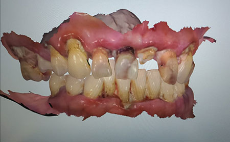 Scan image 2