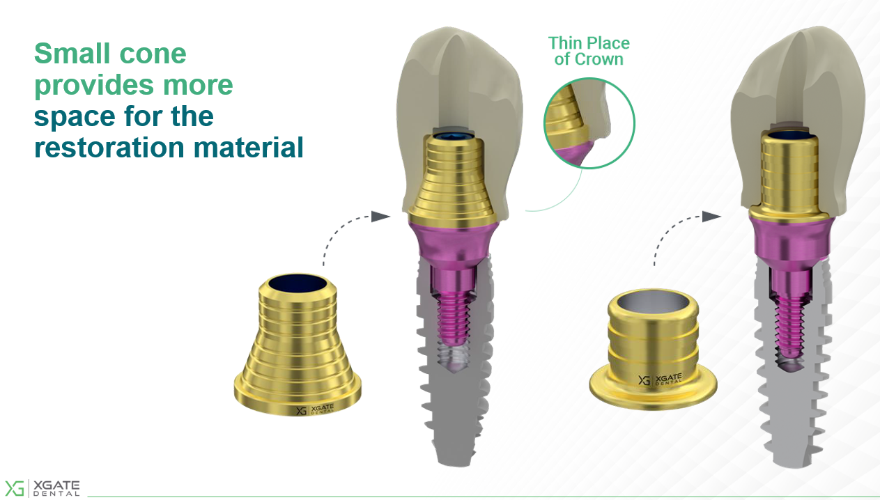 Comparison of small cone and standard dental implant abutments showing thin crown placement