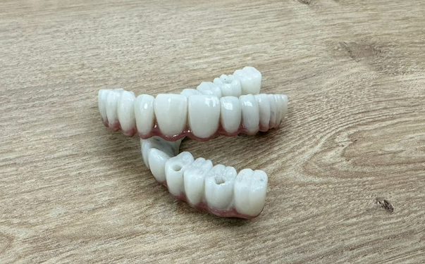 Maxillary and mandibular full-arch zirconia prostheses placed on a table before delivery.