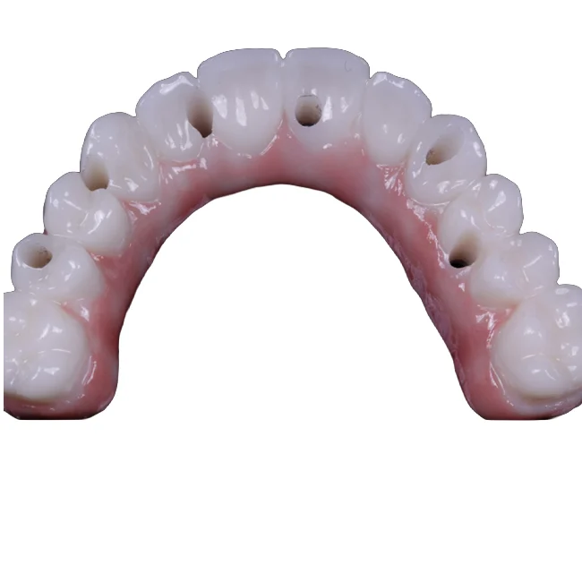 Full-Mouth Rehabilitation. Screw-retained MUA by XGATE