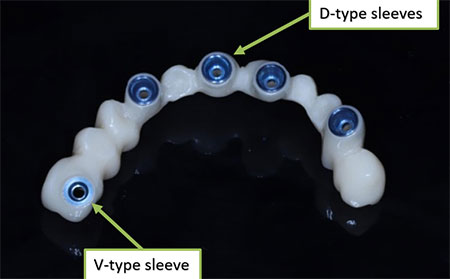Immediate loading on Multi-unit abutments