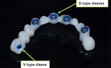 Immediate loading on Multi-unit abutments
