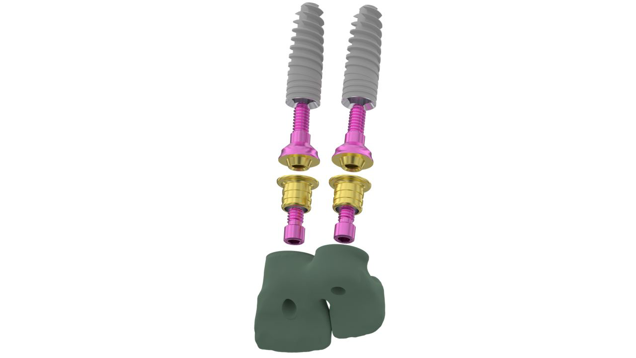 Disassembled screw-retained dental implant prosthesis showing titanium screws, abutments, and full-arch framework