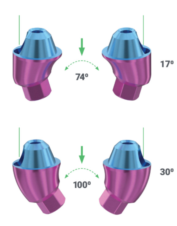 XGate 17° and 30° angled abutments are capable of compensating for implant angulations of up to 74° and 100°, respectively