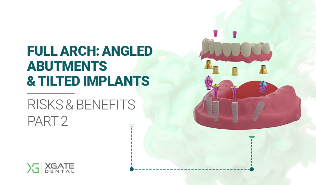 Angled Abutments and Tilted Implants – Risks and Benefits. Part 2