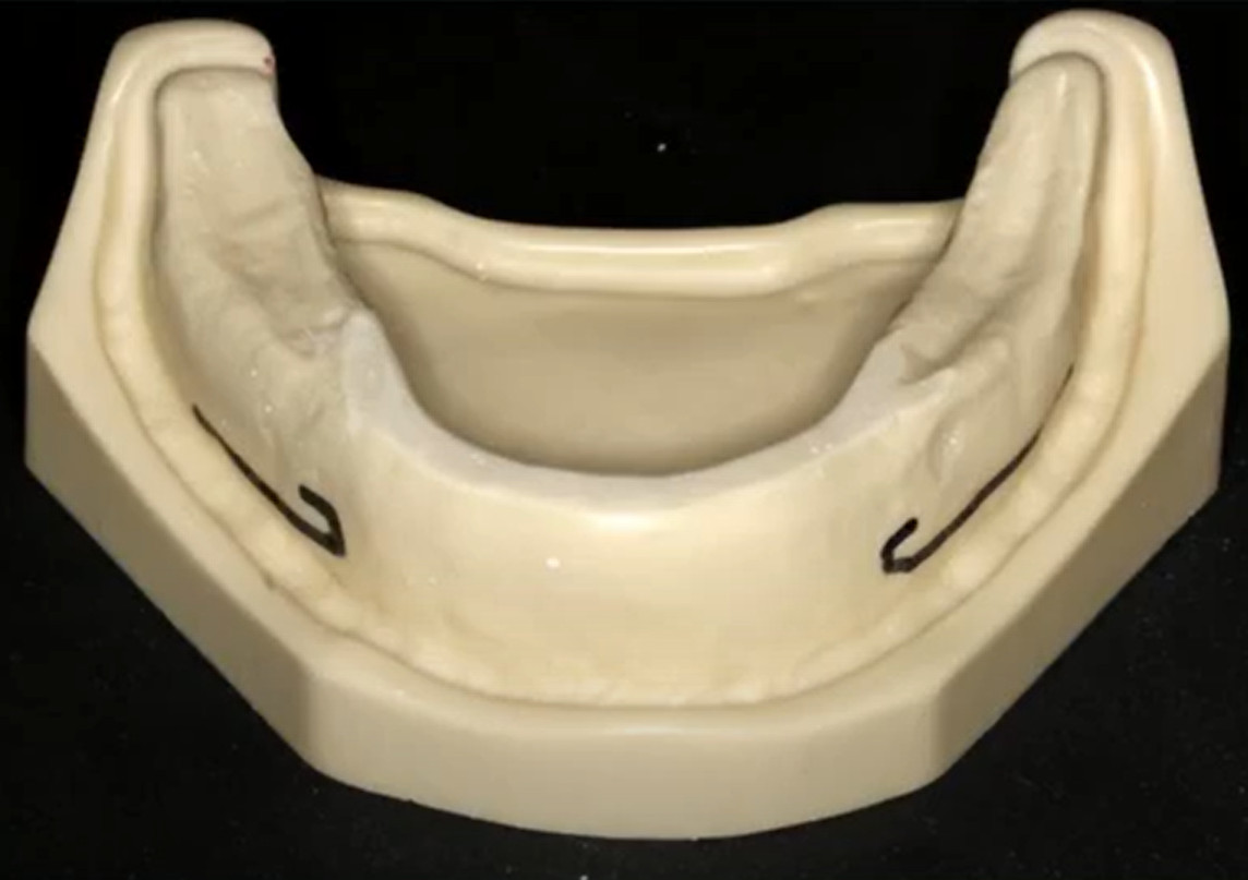 Bare jaw model for training implant placement