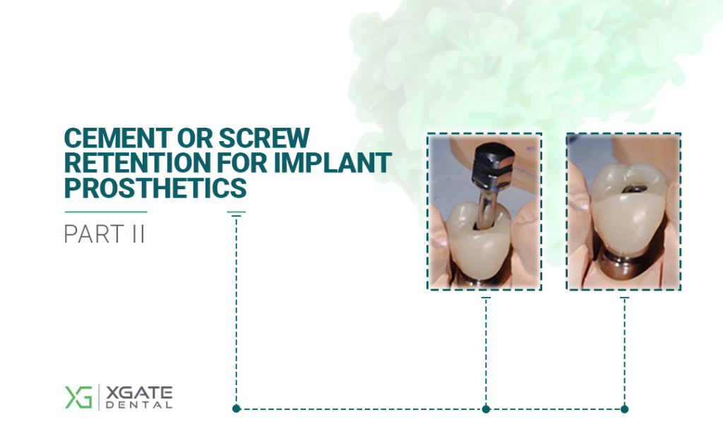 Cement or Screw Retention for Implant Prosthetics. Part 2