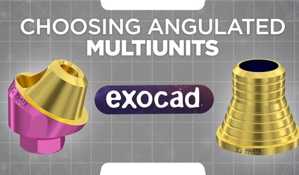 Choosing angulated Multi units