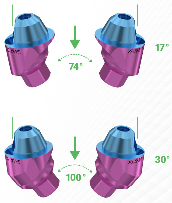 Color-coded dental implant abutments showing different gingival height options