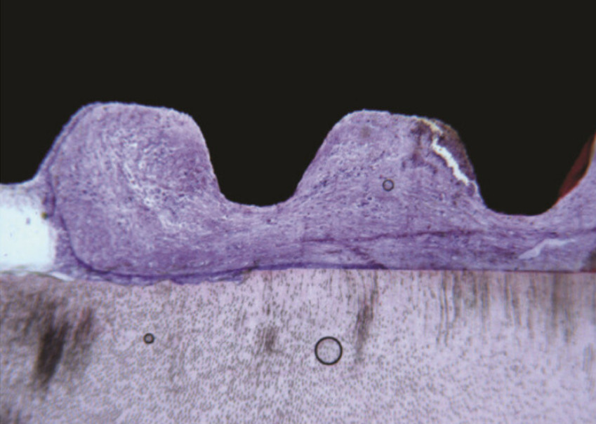In the coronal portion, between the root and the implant, connective tissue without inflammatory infiltrate was present. Acid fuchsin-toluidine blue 40x. YouTube / Dr. Kamil Khabiev / Dental Guru Academy