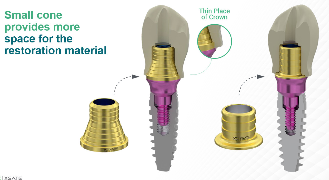 Comparison of standard and reduced cone dental implant abutments showing increased restoration material space with smaller crown placement